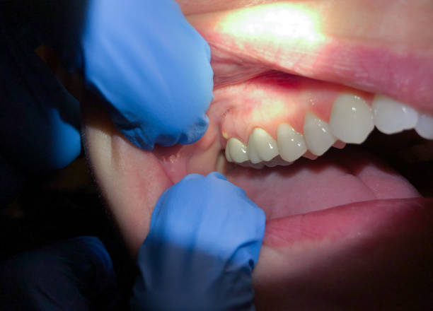 Best 24-Hour Emergency Dentist in Gordon, PA