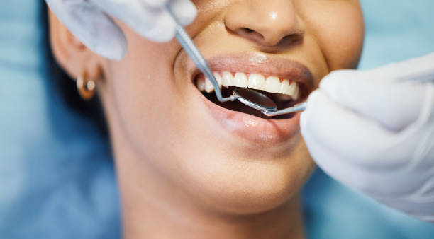 Best Emergency Treatment for Dental Infections or Abscesses in Gordon, PA